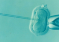 IVF